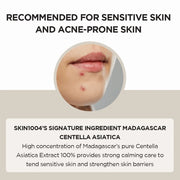 Skin1004 - Madagascar Centella Asiatica Ampoule Facial Serum - 100ml