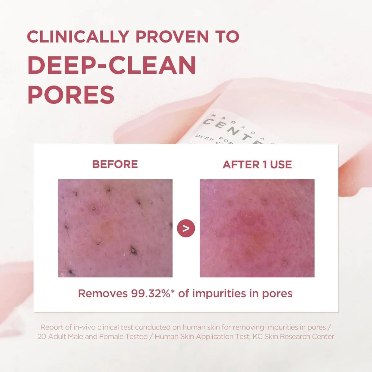 Skin1004 Madagascar Centella Poremizing Deep Cleansing Foam